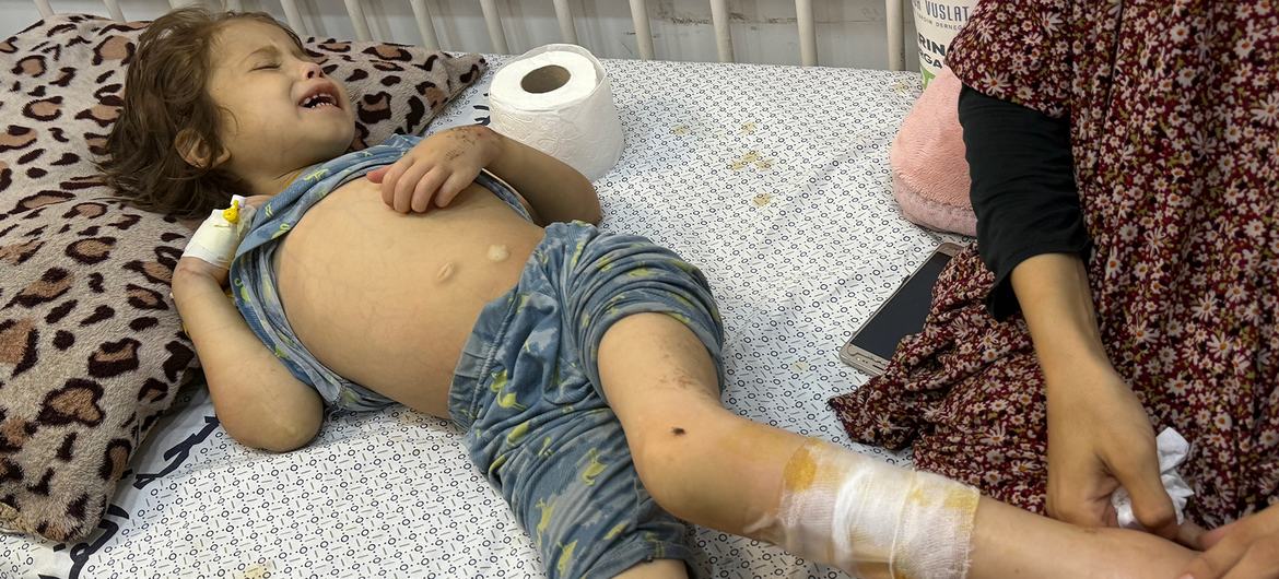 Janah, sete anos, é tratada no Hospital Paciente para Pacientes de Gaza City.